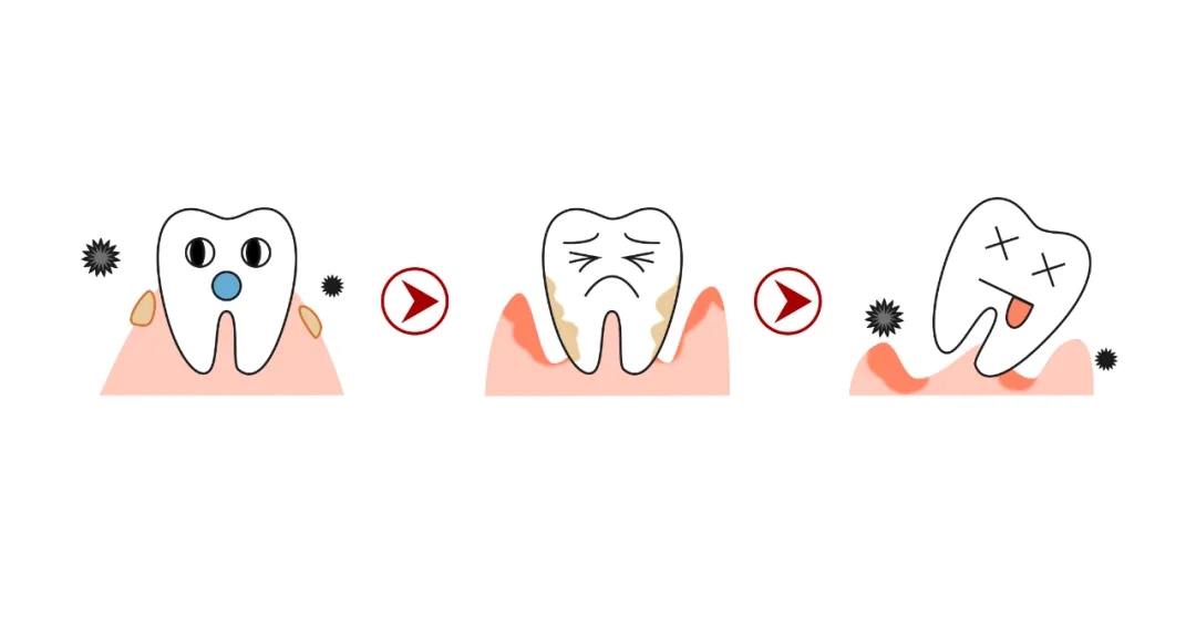 牙齿矫正只是为了把牙排整齐？