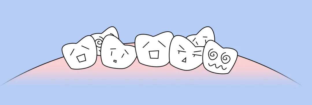 牙齿有些拥挤，需不需要矫正？