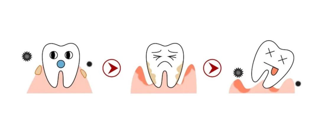 四大方法让你远离牙龈萎缩~
