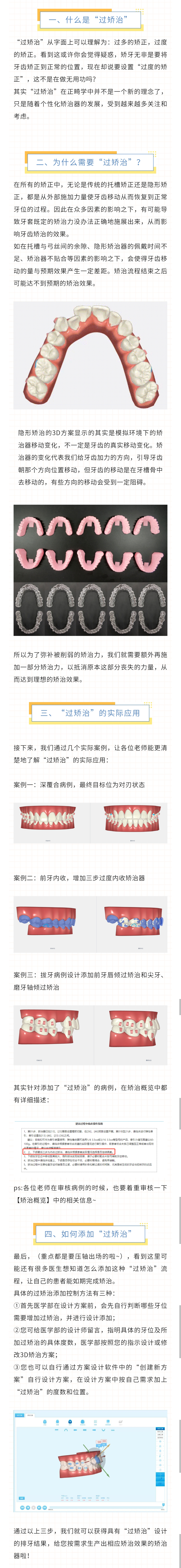 科普|什么是正畸“过矫治”？